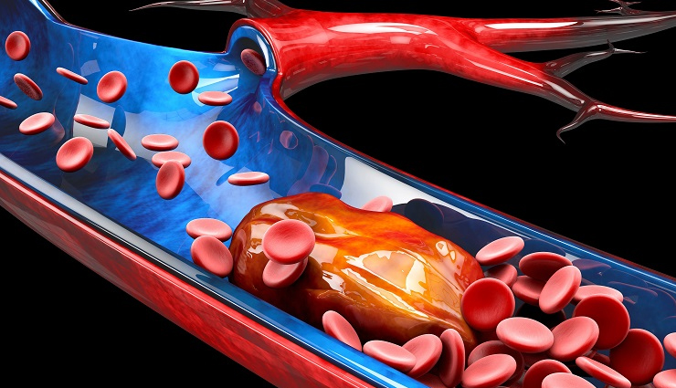 starfruit during pregnancy,health benefits of consuming starfruit,starfruit health benefits,healthy food starfruit,Health,Health tips