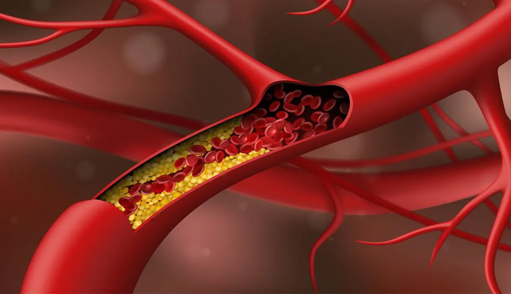 Bad Cholesterol को कम कर देगी ये 8 नेचुरल ड्रिंक्स, पास नहीं फटकेंगी दिल की बीमारियां