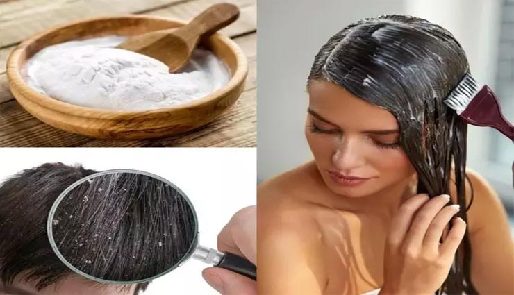 बालों की रूसी का इलाज हैं बेकिंग सोडा, इन तरीकों से करें इसका इस्‍तेमाल