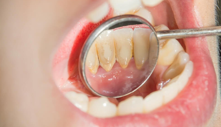 health benefits of baking soda,baking soda,Health tips,fitness tips,home remedies