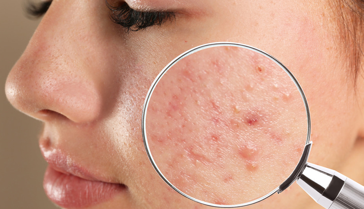 baking soda,beauty benefits of baking soda,skin care tips,beauty tips