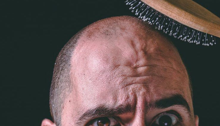 बुढ़ापे में वापिस पा सकेंगे आपने खोए हुए बाल, यह  केश बैंक करेगा आपकी मदद