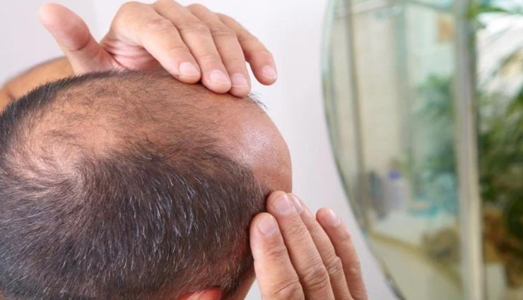 गंजे पुरुषों पर कोरोना संक्रमण के खतरे की रिसर्च, जानें क्या हैं मामला