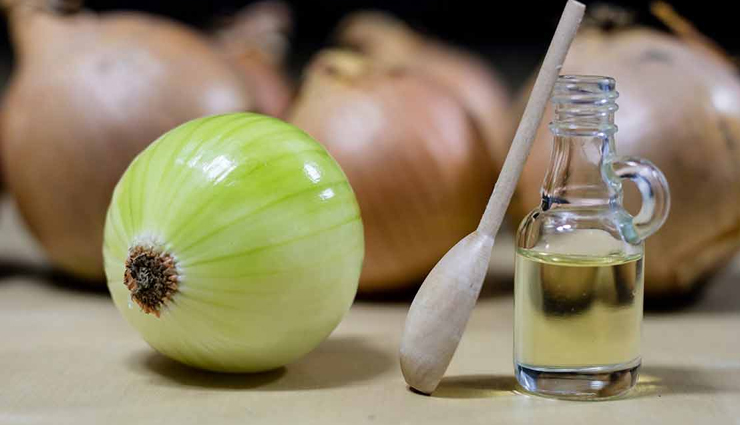 onion juice,eggs,garlic juice,aloe vera gel,amla,chinese hibiscus,home remedies,home remedies for baldness,baldness,beauty tips,hair care tips