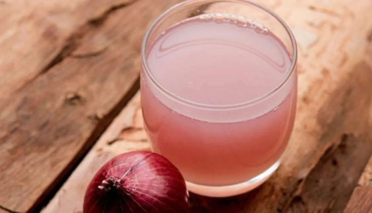 baldness,home remedies to treat baldness,hair care tips,beauty tips