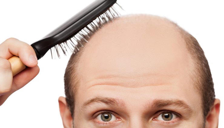 सताने लगा हैं गंजेपन का डर, घर पर बने ये 4 हेयर मास्क बनेंगे सहारा