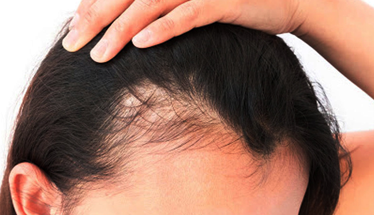 hibiscus for hair,using hibiscus for hair,hibiscus,hibiscus for hair growth,hair care,hair care tips