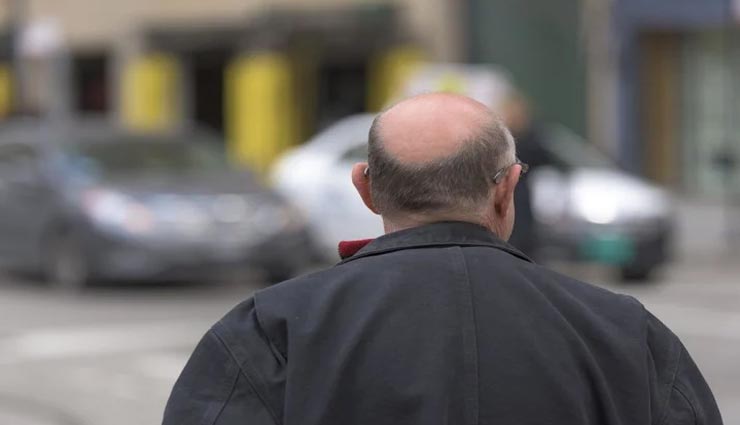 Health tips,health tips in hindi,health research,corona research,coronavirus,corona and baldness