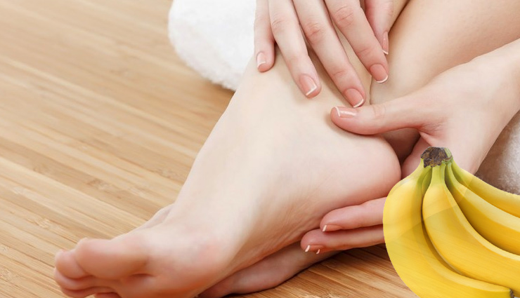 cracked heels,cure cracked heels,home remedies to cure cracked heels,legs beauty,heels beauty,beauty tips,beauty news,beauty hacks,simple beauty tips