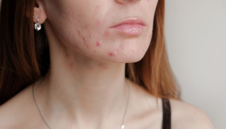 banana peel,ways to use banana peel,skin care tips,beauty tips