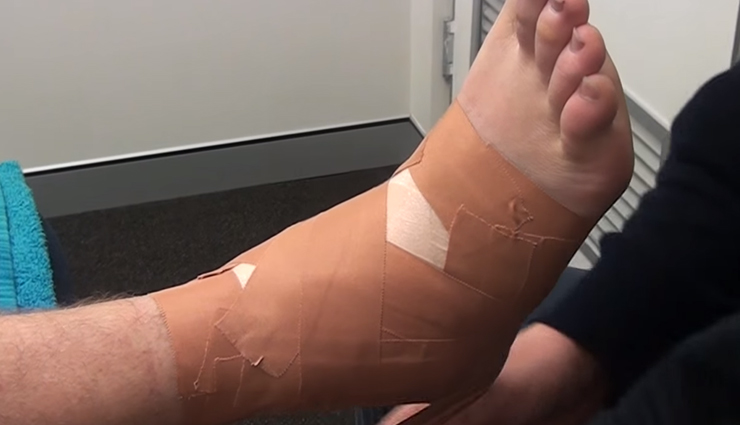 ankle sprain home remedies,natural remedies for ankle sprain,ankle sprain treatment at home,how to treat ankle sprain naturally,diy ankle sprain remedies,ankle sprain relief,herbal remedies for ankle sprain,holistic remedies for ankle sprain,ankle sprain pain relief,ankle sprain remedies for swelling,ankle sprain remedies for inflammation,ankle sprain remedies for bruising,ankle sprain exercises,ankle sprain recovery tips,ankle sprain remedies for athletes,rice method for ankle sprain,ankle sprain prevention tips,Health,Health tips