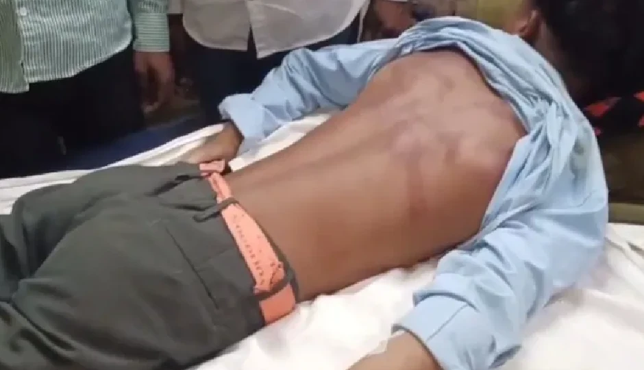 बांसवाड़ा में 12वीं के छात्र का दिनदहाड़े अपहरण, 4 किमी दूर झाड़ियों में गंभीर हालत में मिला