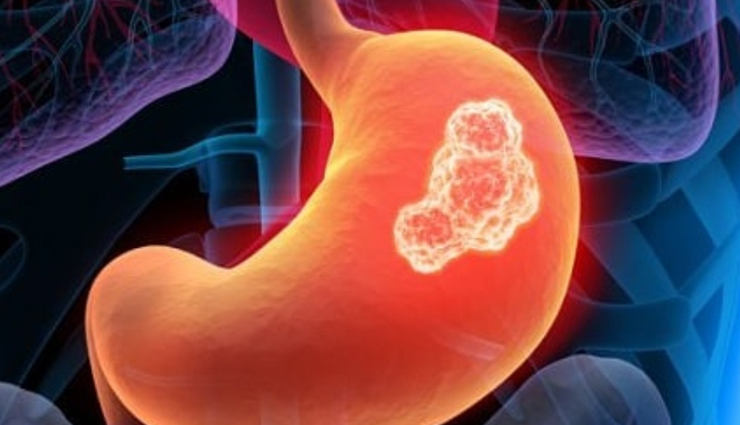 basil leaves,health benefits of basil leaves,Health tips,fitness tips