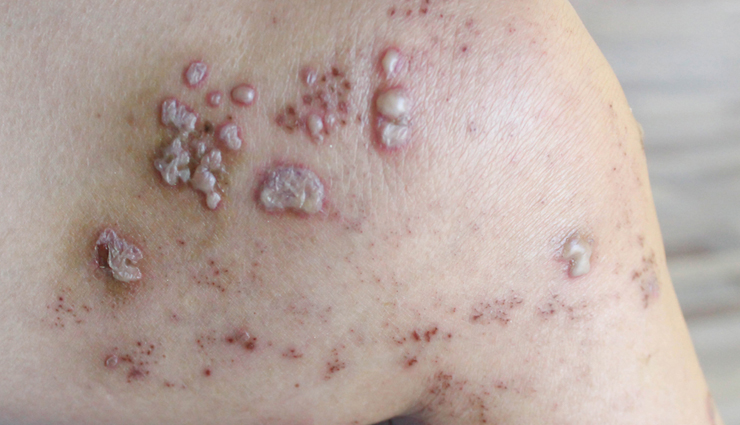 basil seeds,health benefits of basil seeds,Health tips,fitness tips