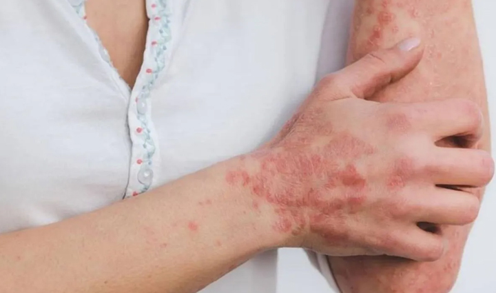 सर्दियों में जरूर करें बथुआ का सेवन, सेहत को मिलेंगे ये जबरदस्त फायदे winter health benefits of bathua,reasons to consume bathua in winter,tremendous health benefits of winter bathua,bathua advantages for winter well-being,must-have winter superfood: bathua,nutritional benefits of consuming bathua in winter,winter wellness with bathua consumption,bathua and its health perks in winter,boost your health with winter bathua,incredible advantages of eating bathua during winter