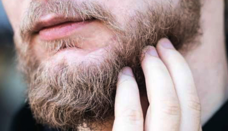 5 Must Try Ways To Get Rid of Beard Dandruff