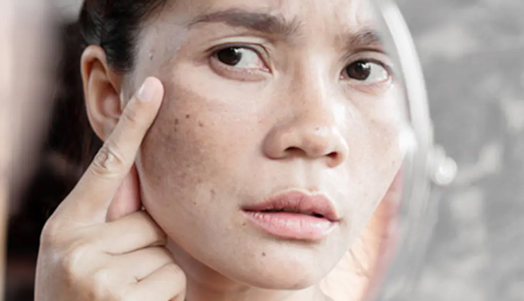 tomato skincare benefits,healthy skin with tomatoes,tomato remedies for glowing skin,tomato skincare hacks,tomatoes for radiant complexion,natural skin remedies with tomatoes,tomato-based skincare routines,tomato skincare tips,tomatoes for sunburn relief,tomato facial treatments