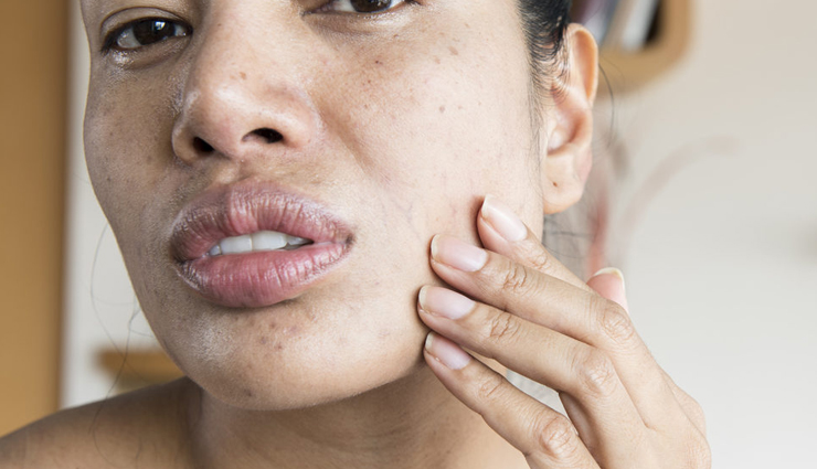 tomato skincare benefits,healthy skin with tomatoes,tomato remedies for glowing skin,tomato skincare hacks,tomatoes for radiant complexion,natural skin remedies with tomatoes,tomato-based skincare routines,tomato skincare tips,tomatoes for sunburn relief,tomato facial treatments