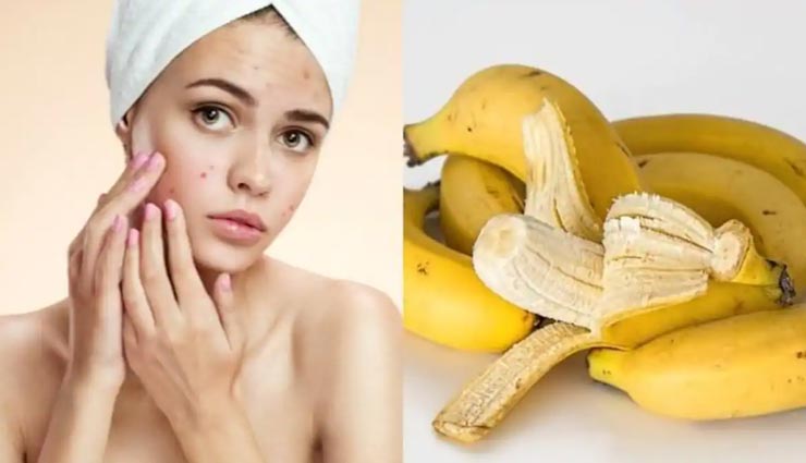 beauty tips,beauty tips in hindi,skincare tips,fruits peel for beauty