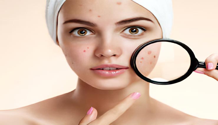 beauty tips,beauty tips in hindi,home remedies,black heads remedies,homemade scrub