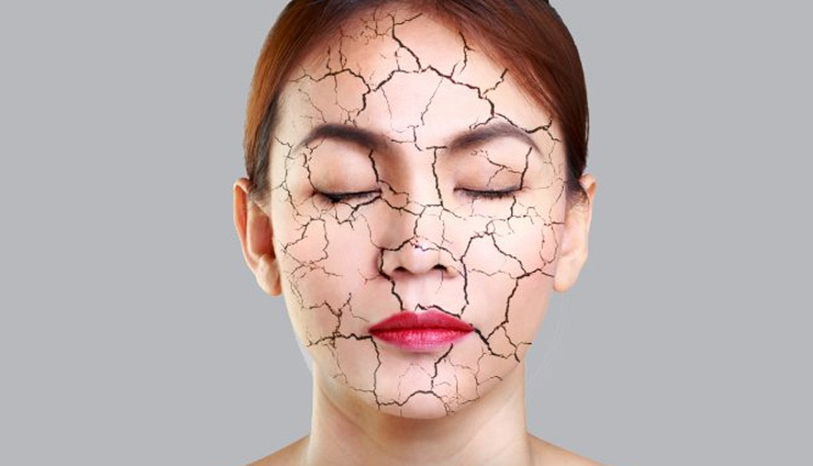 dry skin,home remedies for dry skin,skin care tips,winter tips,beauty tips