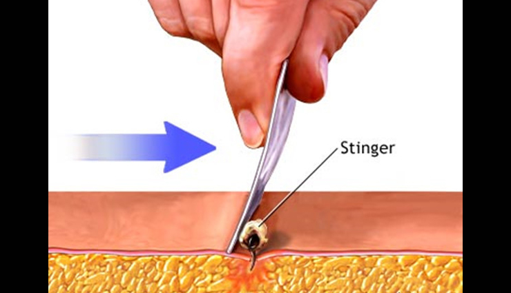 Health tips,healthy living,understanding basic first aid,how to give basic first aid,basic first aid during accidents,first aid tips