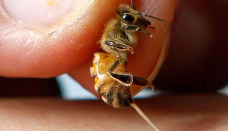 5 Ways To Treat Bee Sting at Home