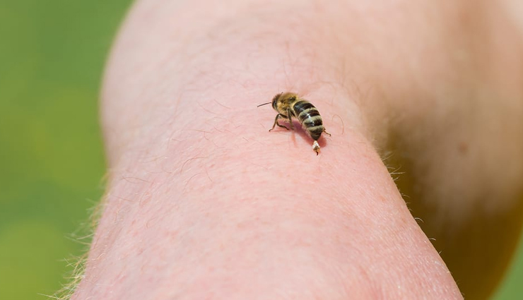 5 Home Remedies To Treat Bee Stings