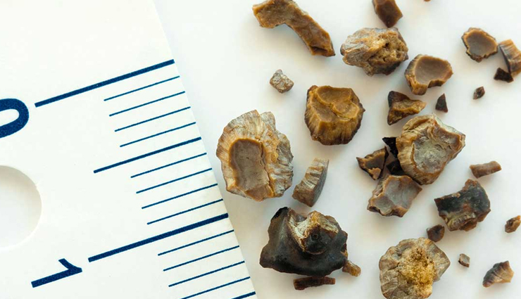 beet greens health benefits,benefits of eating beet greens,beet greens nutrition benefits,amazing beet greens health benefits,beet greens for health and wellness,nutritional value of beet greens,beet greens and their health advantages,beet greens benefits for the body,why beet greens are healthy,antioxidants in beet greens,vitamins in beet greens,minerals in beet greens,dietary fiber in beet greens,phytonutrients in beet greens,beet greens and bone health,beet greens for digestive health,heart health benefits of beet greens,anti-inflammatory properties of beet greens,immune-boosting beet greens