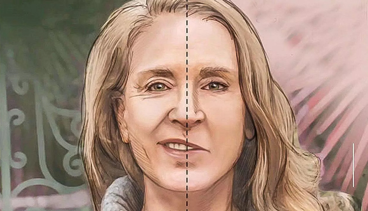 13 Home Remedies For Bell's Palsy