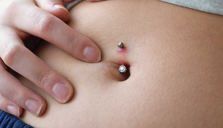 5 Effective Home Remedies To Treat Belly Button Infection