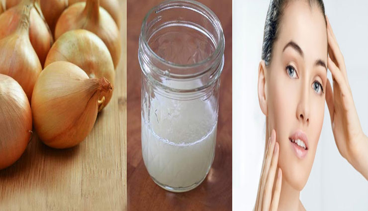 आँखों में आंसू लाने वाला प्याज चेहरे की सुन्दरता बढाता हैं, जानें इसके ब्यूटी टिप्स