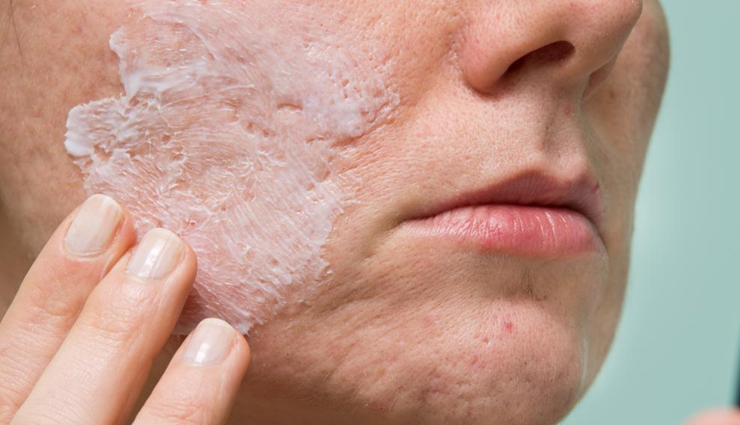 acne-fighting ingredients,natural remedies for acne,ingredients for acne treatment,anti-acne ingredients,skincare ingredients for acne-prone skin,acne-fighting remedies,ingredients to combat acne,natural acne solutions,effective acne-fighting ingredients,acne treatment options,ingredients for clear skin,skincare for acne
