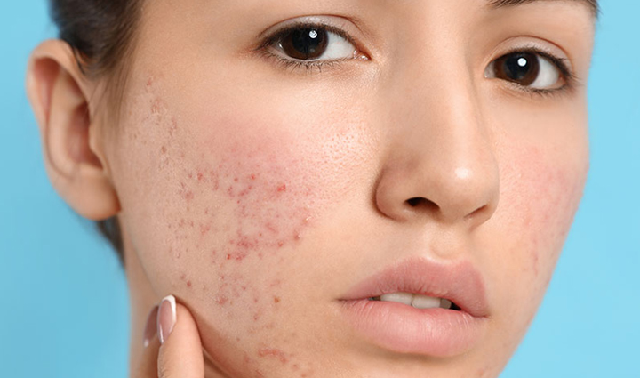 most amazing benefits of bhringraj powder for your skin,beauty tips,beauty hacks