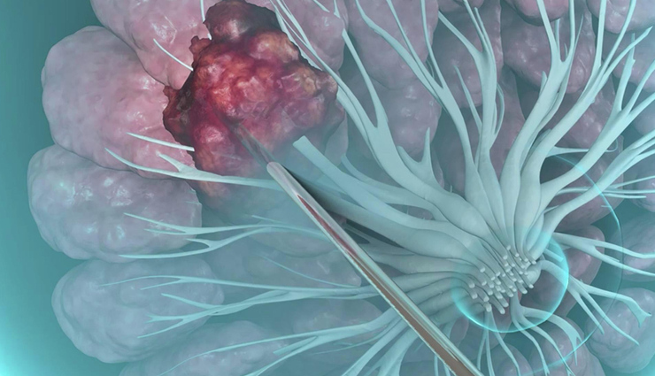 breast cancer screening tests,early detection of breast cancer,best tests for breast cancer diagnosis,importance of timely breast cancer screening,mammogram for breast cancer detection,breast cancer prevention checkup,how to detect breast cancer early,breast ultrasound for cancer screening,mri for breast cancer detection,when to get tested for breast cancer,biopsy for breast cancer diagnosis,risk factors for breast cancer detection