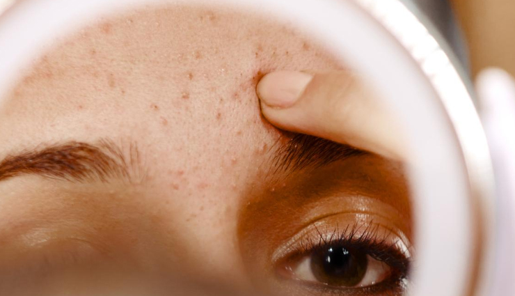 bishops weed for skin,bishops weed,skin care tips,beauty tips