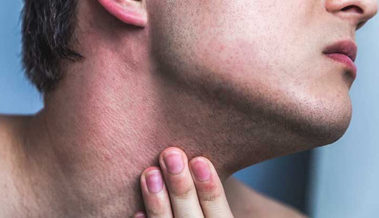 bishops weed for skin,bishops weed,skin care tips,beauty tips