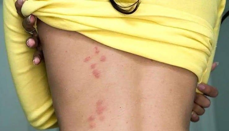 banana peel benefits,health benefits of banana skin,banana peel nutrition,uses of banana peel,banana peel tea benefits,banana skin health advantages,edible banana peel benefits,banana peel antioxidants,banana peel vitamins,banana skin medicinal properties