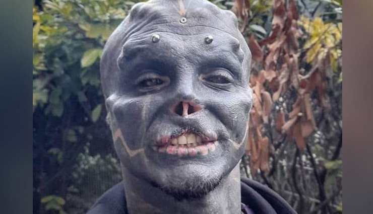 नाक और ऊपर के होंठ कटवाना इस शख्स को पड़ा भारी, अब बोलने में हो रही है तकलीफ