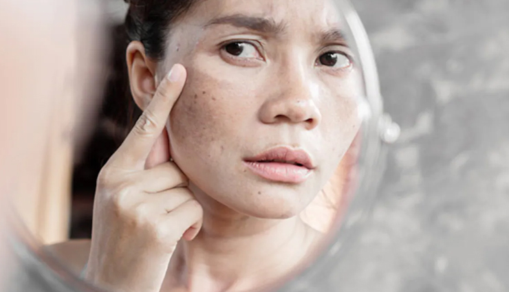 black cumin seed oil,beauty benefits of black cumin seed oil,skin care tips,beauty tips