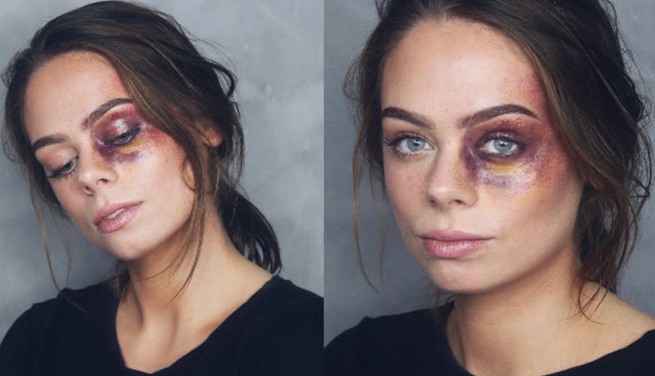 home remedies,home remedies to treat black eye,eye care tips,Health tips,fitness tips