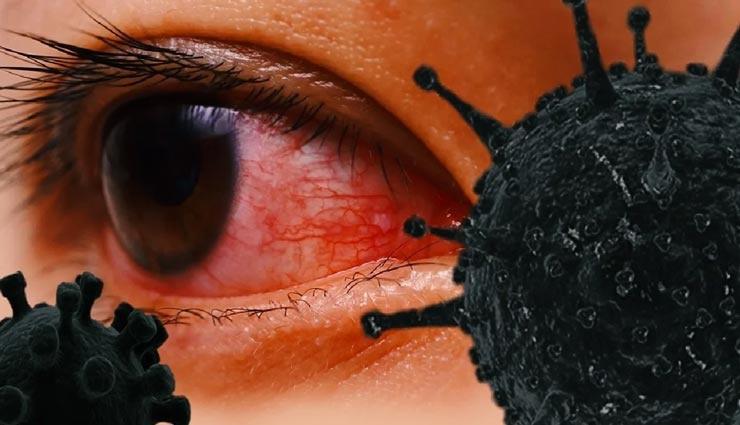 राजस्थान : कोरोना के साथ मंडराने लगा ब्लैक फंगस का भी खतरा, मिल चुके 1345 मरीज, 50 की गई जान