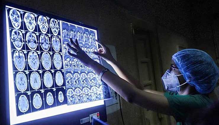 अलवर : महिला की मौत का कारण बना ब्लैक फंगस, समय पर ना मिल पाया इंजेक्शन