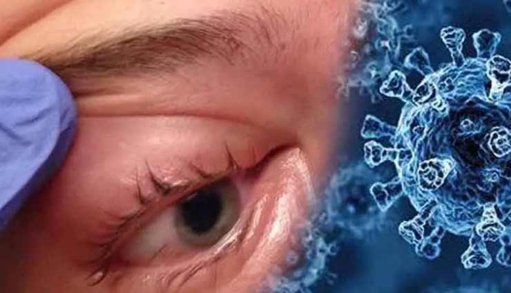 केंद्र-राज्य की राजनीति में फंसे ब्लैक फंगस के लाचार मरीज, 48 घंटे से किसी अस्पताल में नहीं हैं जरूरी इंजेक्शन 