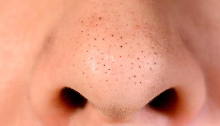 beauty tips,beauty tips for face,glowing skin,radiant skin,skin care tips,beauty tips for girls