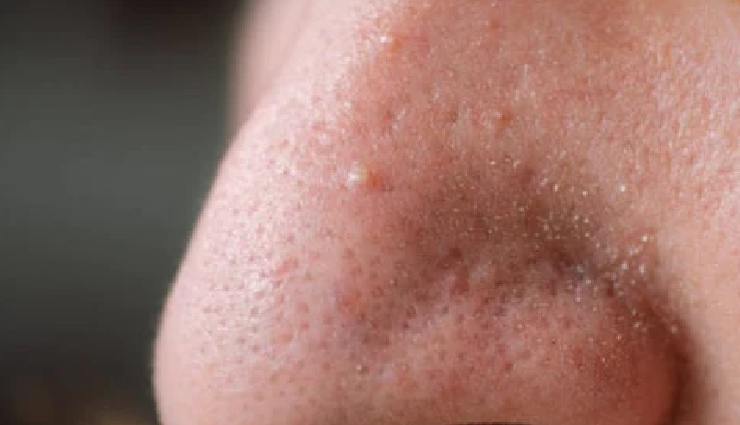 facial for men,men skincare benefits,benefits of facial treatments for men,acne treatment for men,anti-aging facials for men,skincare routine for men,men facial massage benefits,clearing pores for men,dark circles treatment for men,blackhead removal for men,skin detoxification for men,facial glow enhancement for men,razor burn relief for men,men skincare regimen,healthy skin tips for men,diy facial for men,men facial rejuvenation,preventing skin damage in men,men grooming tips,facial skincare guide for men