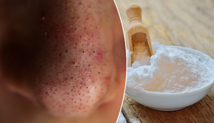home remedies for skin problems,natural remedies for skin,treat skin issues at home,effective skin care remedies,oily skin treatment,dry skin remedies,anti-aging skin care,pimple and acne treatment,skin burn remedies,blackheads and whiteheads removal,unwanted hair removal,damaged skin healing