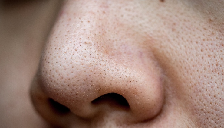 lemon for skin,lemon beauty benefits,lemon for dark spots,natural skin remedies,vitamin c for skin,lemon face treatments,pigmentation removal,lemon home remedies,lemon for clear skin,natural bleaching agent,even skin tone tips