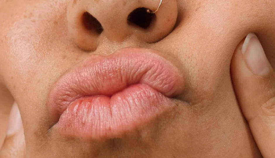 काले होंठों को कुछ ही दिनों में गुलाबी बनाने का घरेलू उपाय, चीनी के साथ ये 2 चीजें मिलाकर लगाए