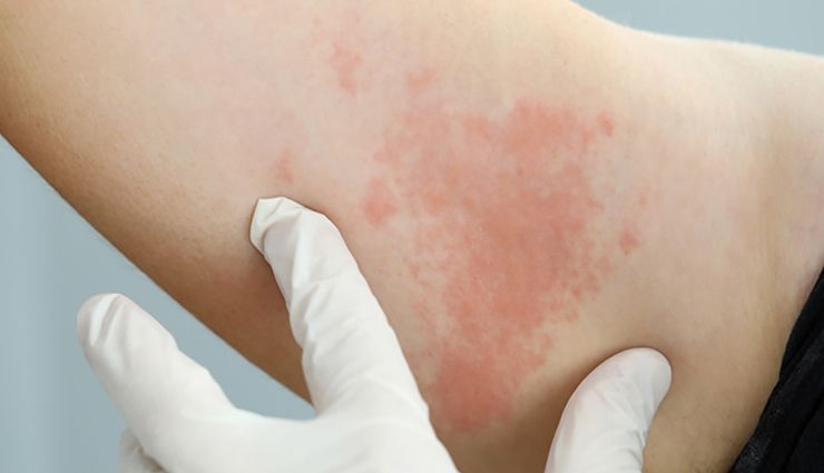 black seed oil,health benefits of black seed oil,Health tips,fitness tips